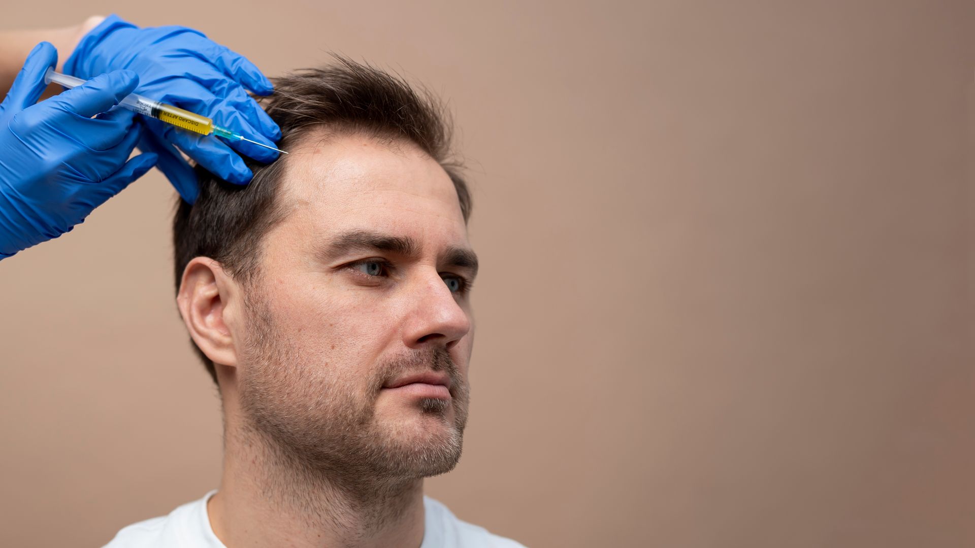 Man receiving injection in scalp, blue-gloved hand holding syringe; beige background.