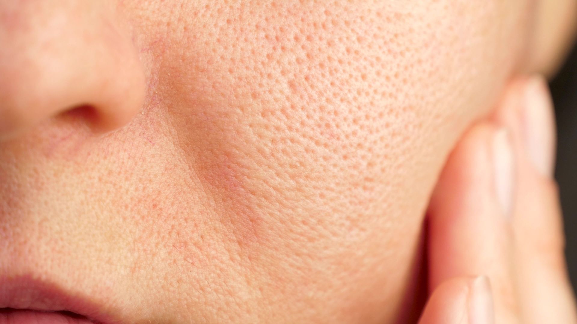 Close-up of human cheek skin showing visible pores and natural texture.