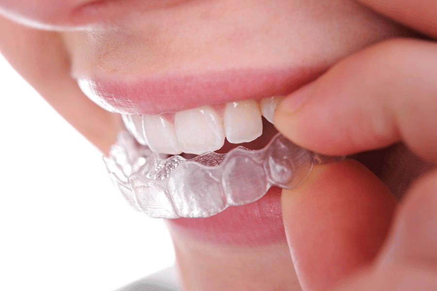 Plastic Teeth  — Plymouth, MI — Leslie M Woodell DDS