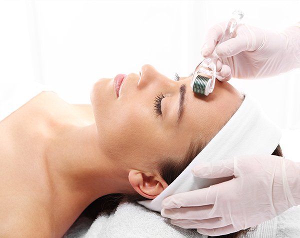 RF Microneedling — Frankfort, IL — Midwest Anti-Aging and Med Spa