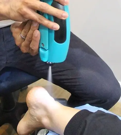 A person's ankle being sprayed with a teal-colored device by someone seated. The setting appears to be a medical office.