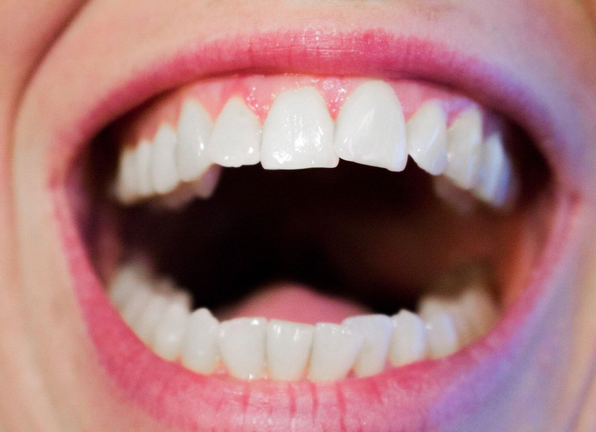 A close up of a person 's teeth with their mouth open.