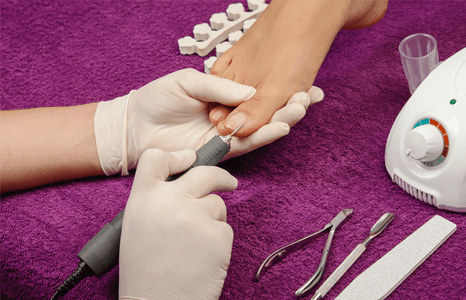 Ingrown toenail treatments