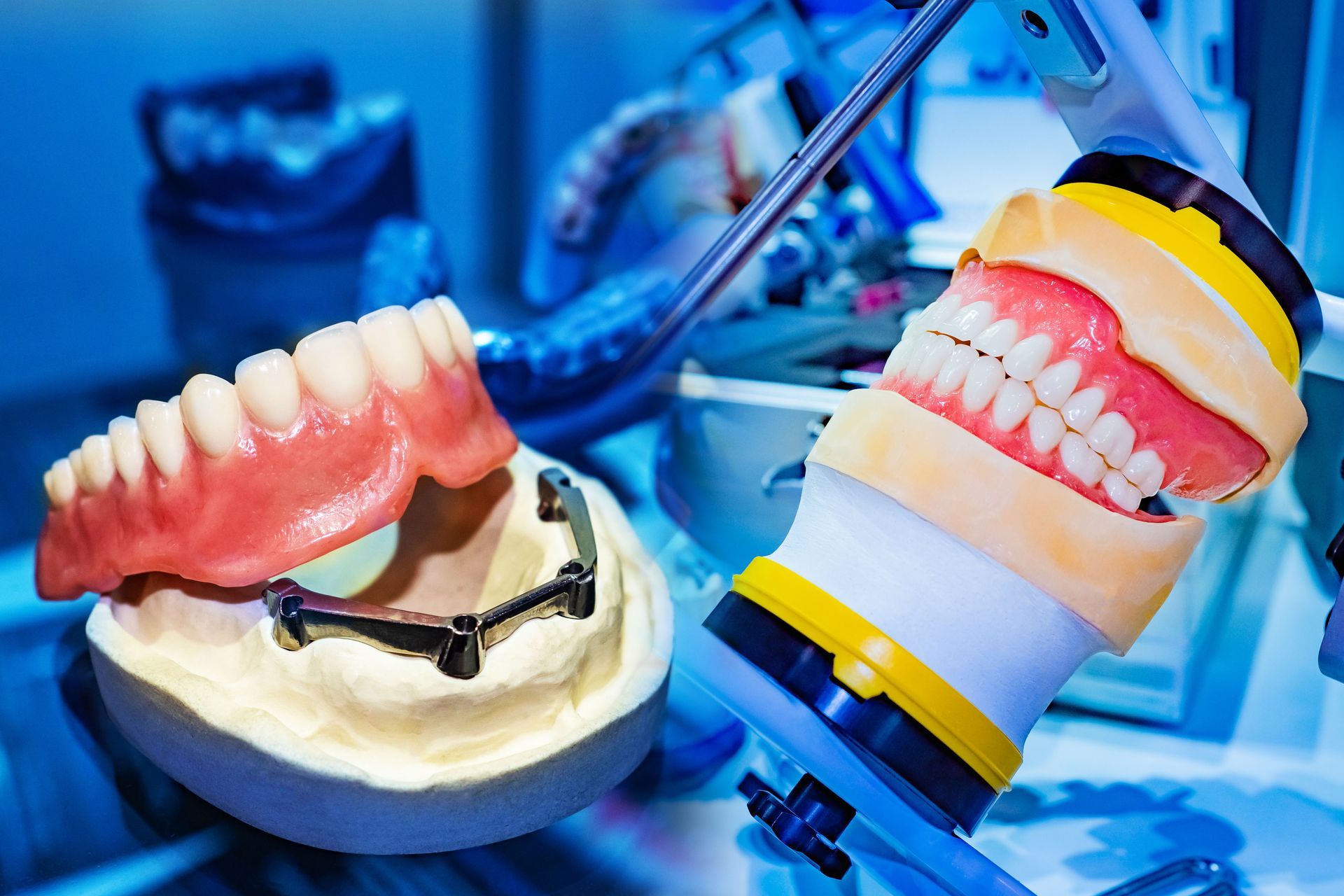 Dental dentures on display in a blue clinical setting with dental tools and model teeth