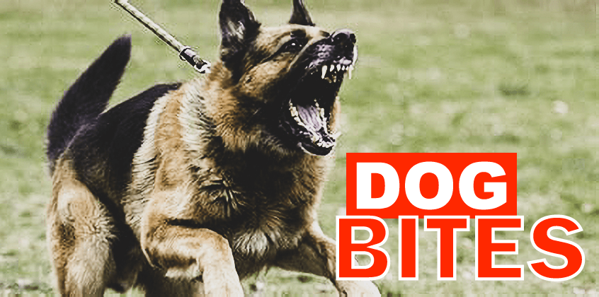 dog bite dog attack lawyer