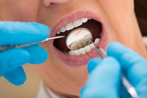 Teeth Examination — Root Canal Treatment in Oakhurst, CA