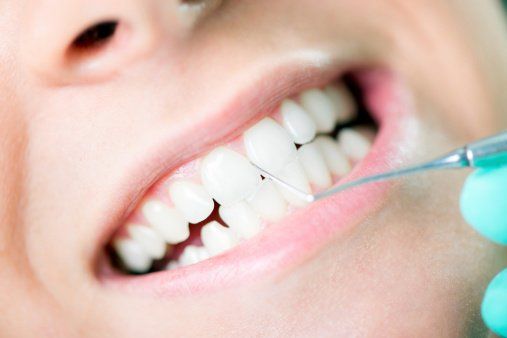 Dental Cleaning — Dental Health in Oakhurst, CA