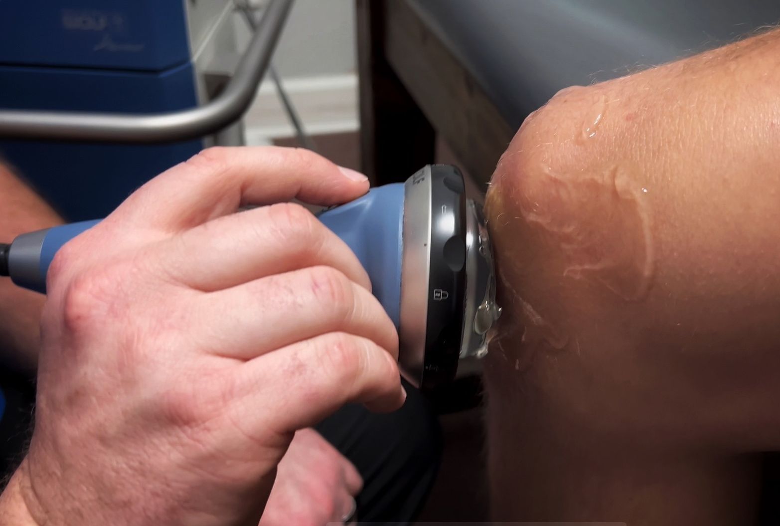 Acoustic Shockwave Therapy