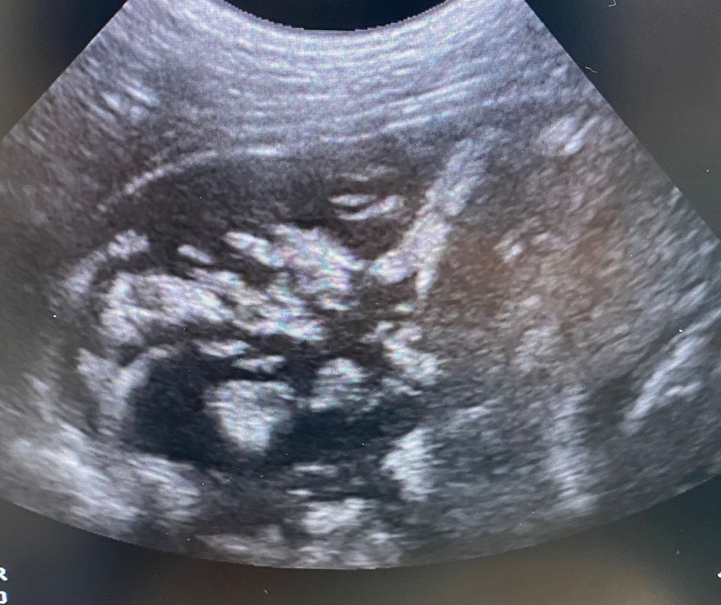 Echographie chien chat