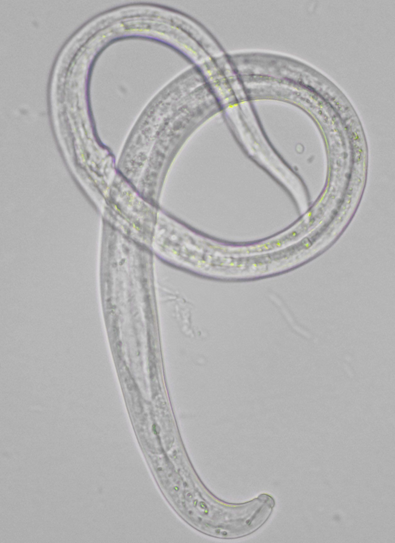Transparenter Fadenwurm in gebogener Form, unter dem Mikroskop betrachtet.