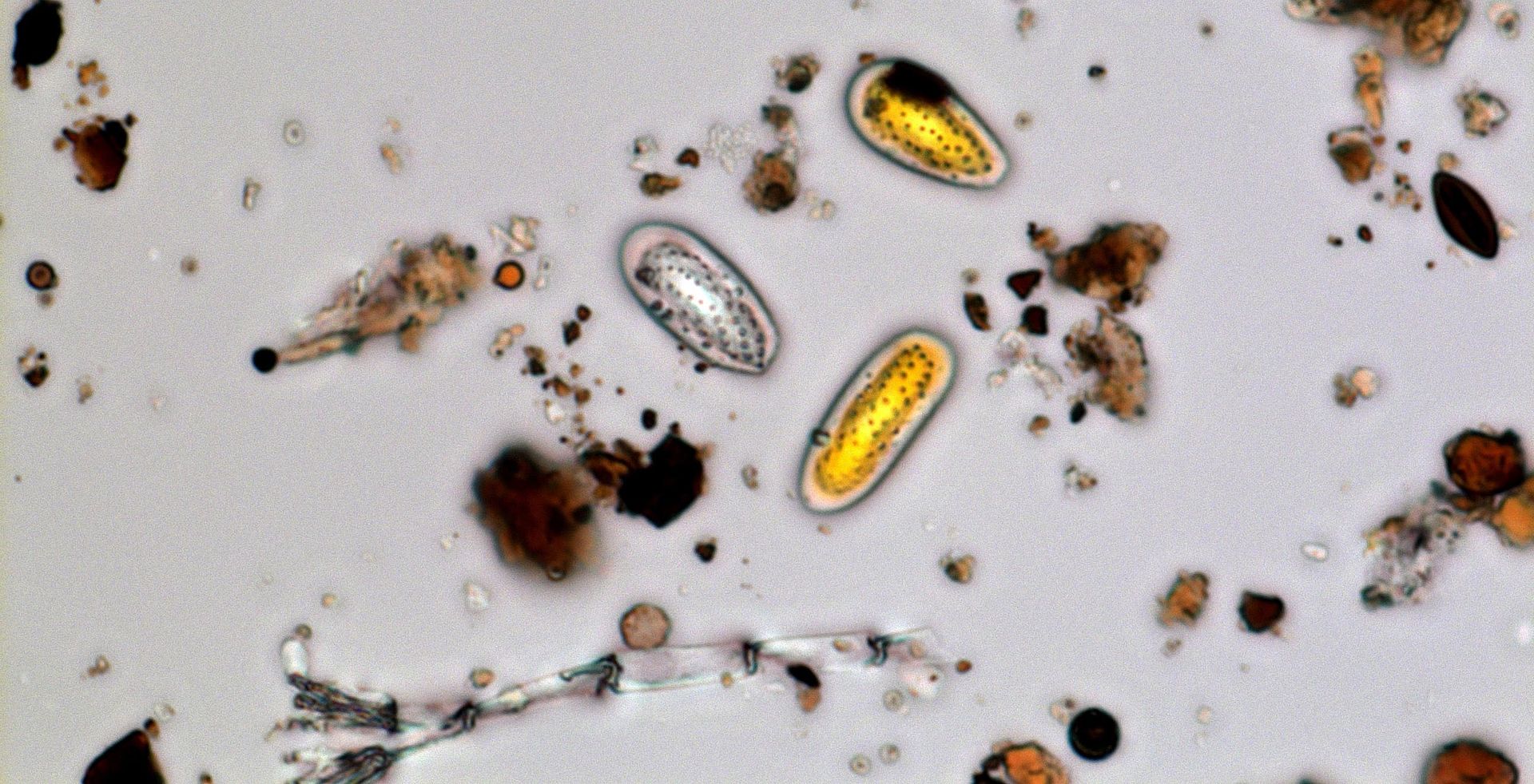 Mikroskopische Ansicht verschiedener Partikel, darunter mehrere ovale Parasiteneier mit gelblichem Inneren.