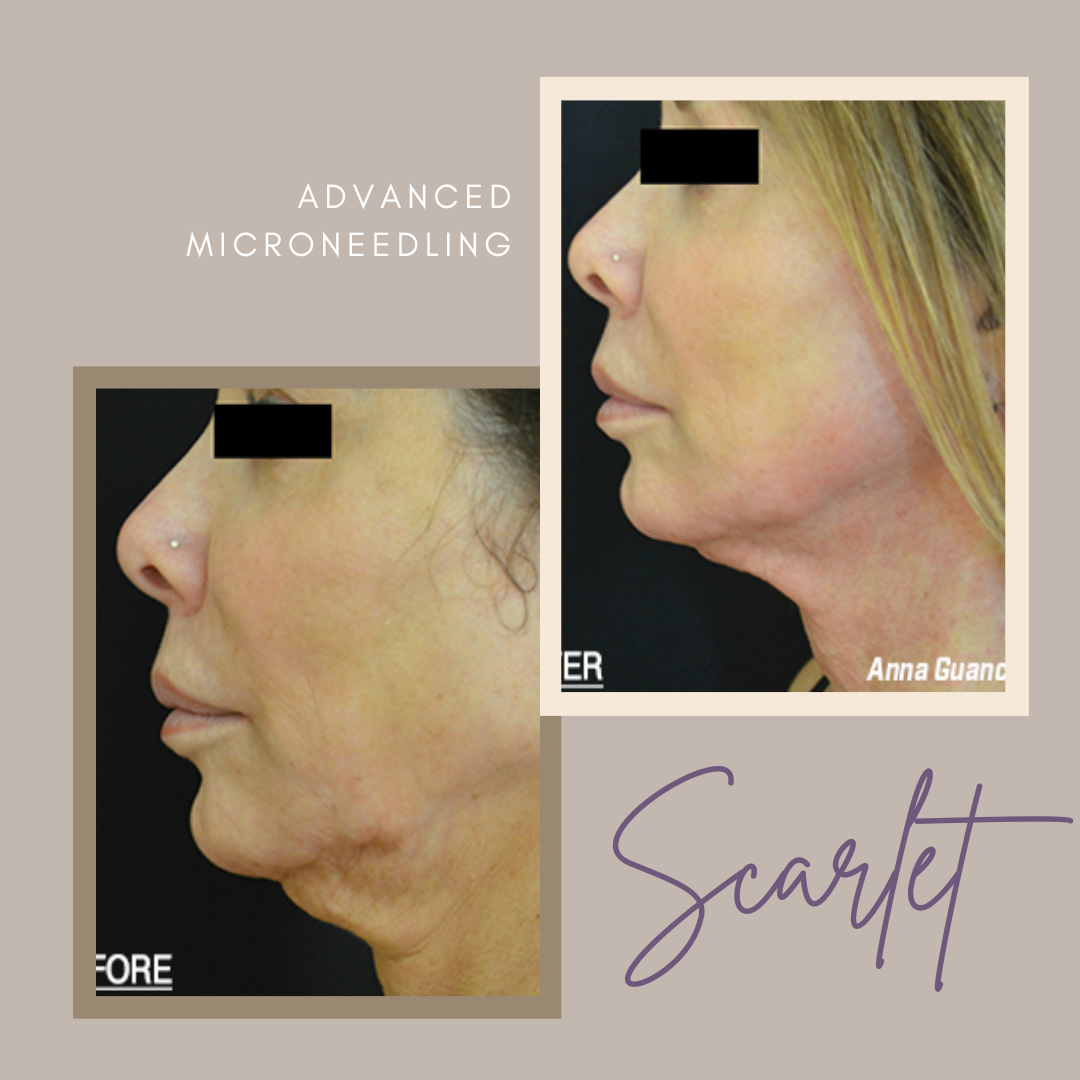 Pure Skin MedSpa Gallery