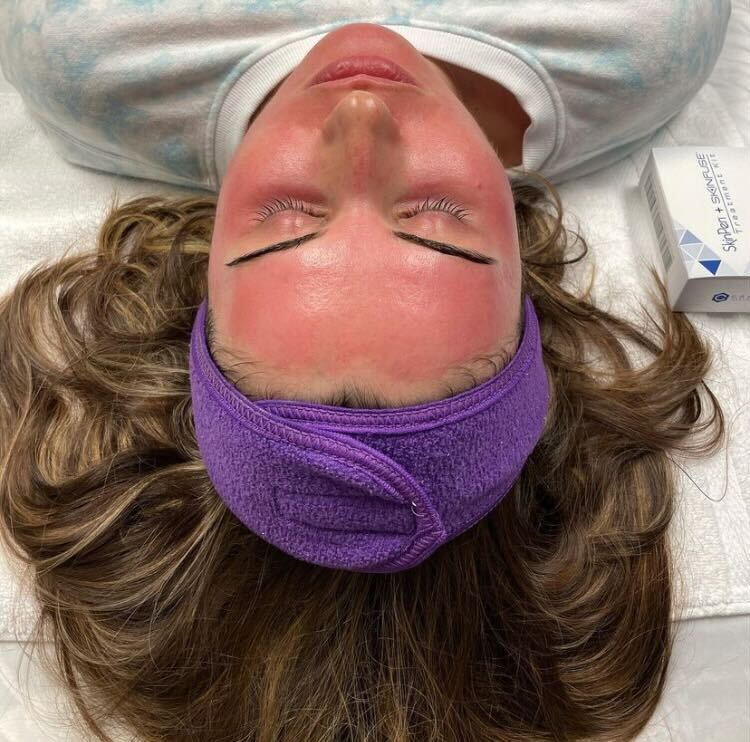 Pure Skin MedSpa Gallery