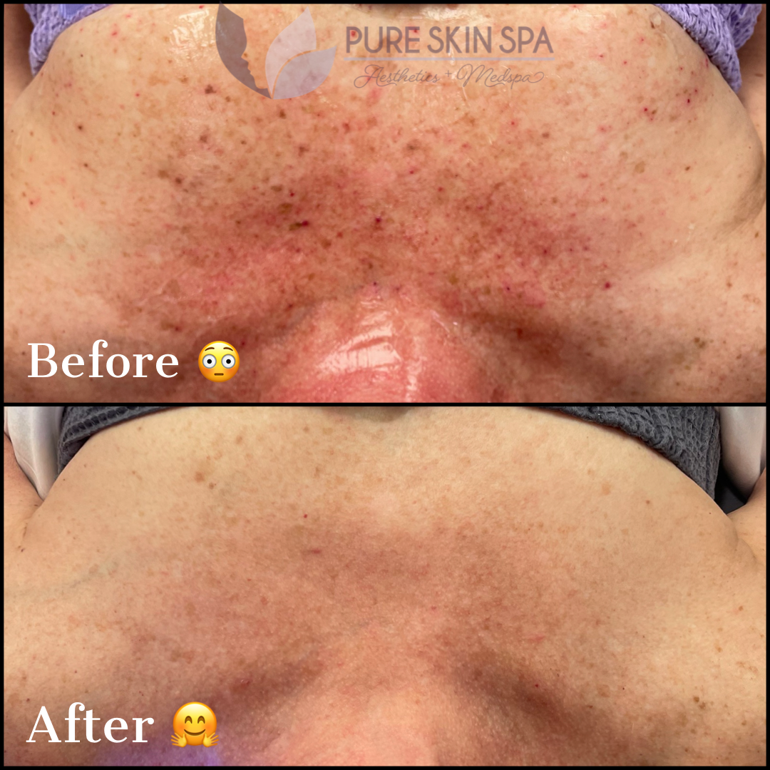 Pure Skin MedSpa Gallery