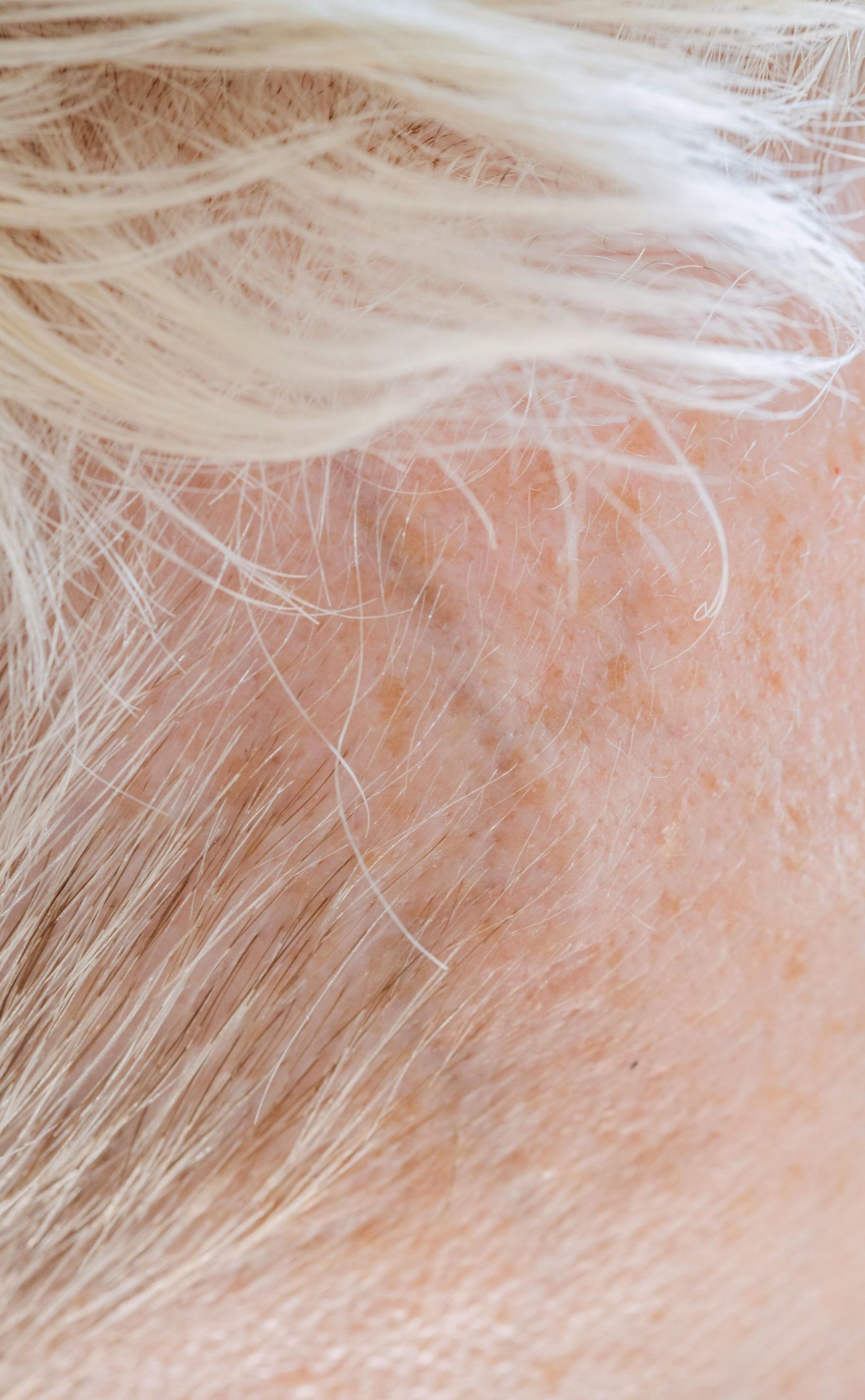 A close up of a woman 's head with white hair and freckles.