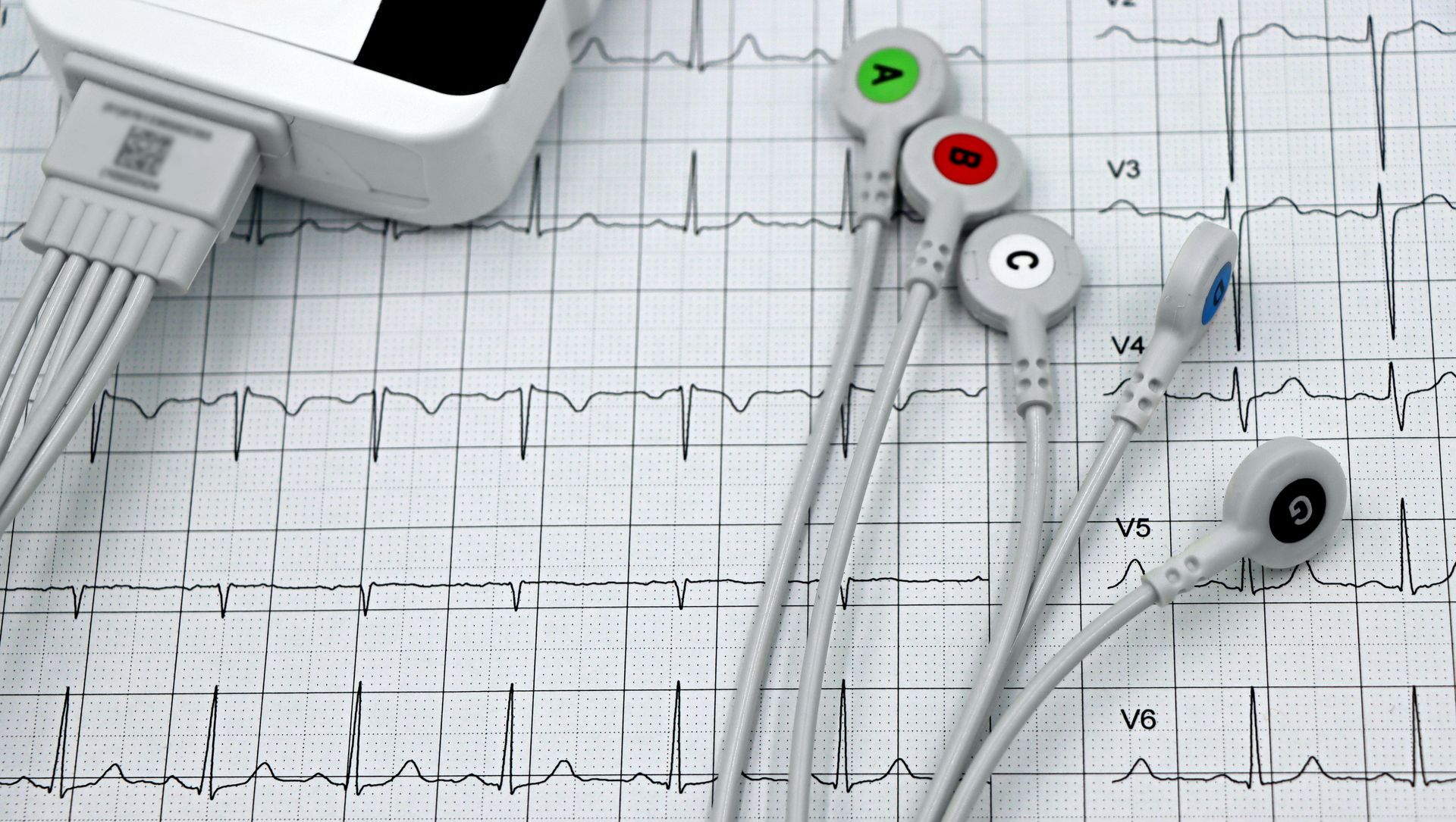 A heart monitor is sitting on top of an ecg chart