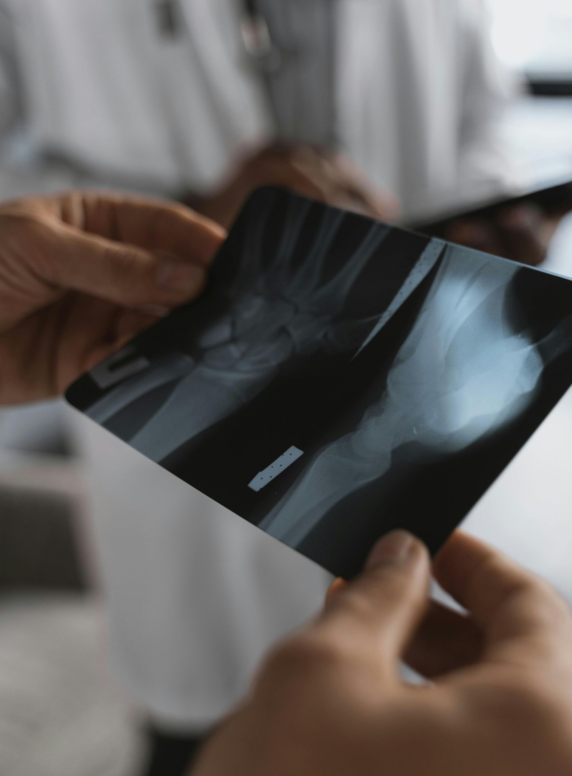 A person is holding an x-ray of a hand.