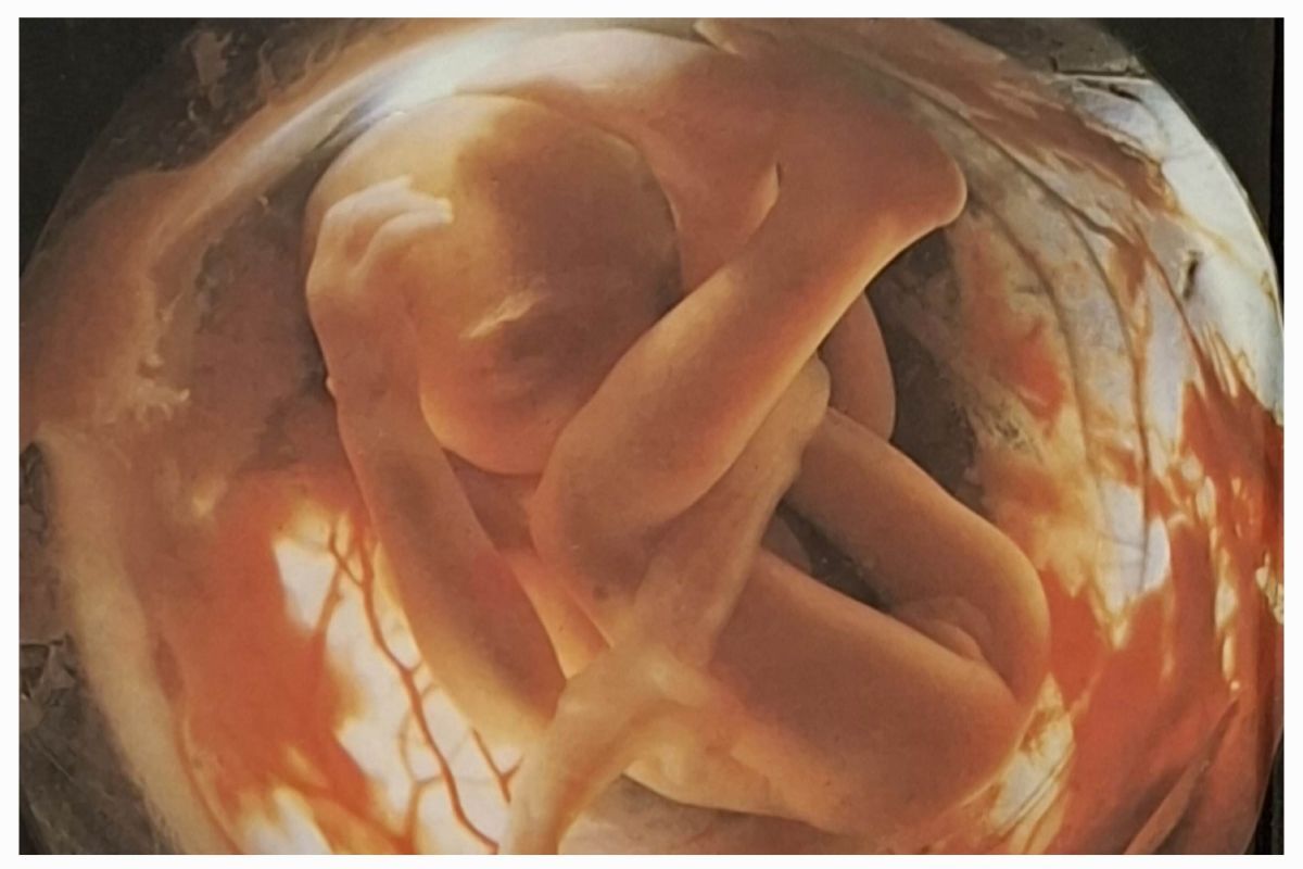 Het grote wonder. 14de druk in 1987 fotograaf Lennart Nilson kindje 5de mnd.