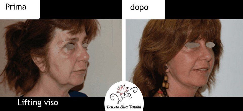 Trattamento viso prima e dopo