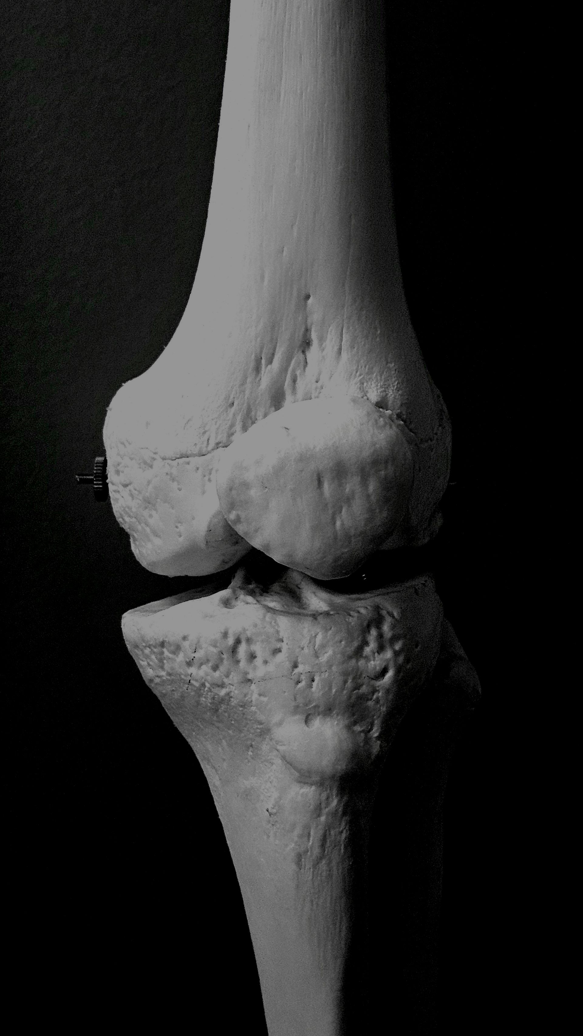 A close up of a knee joint on a black background.
