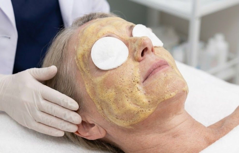Client having enzyme facial with cotton pads protecting the eyes