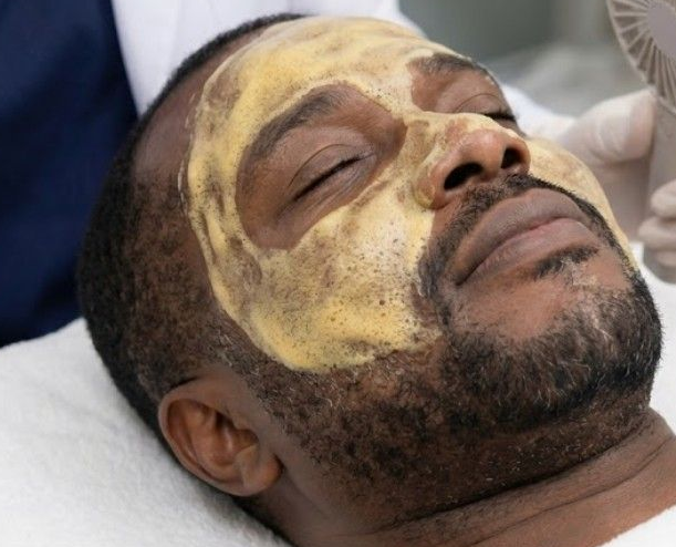 client letting enzyme peel take effect