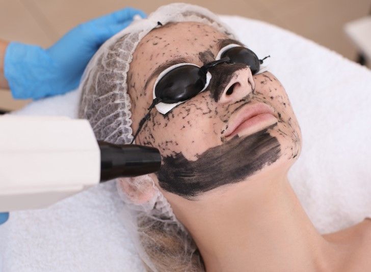 The Skinutrition Clinic performing a carbon laser facial