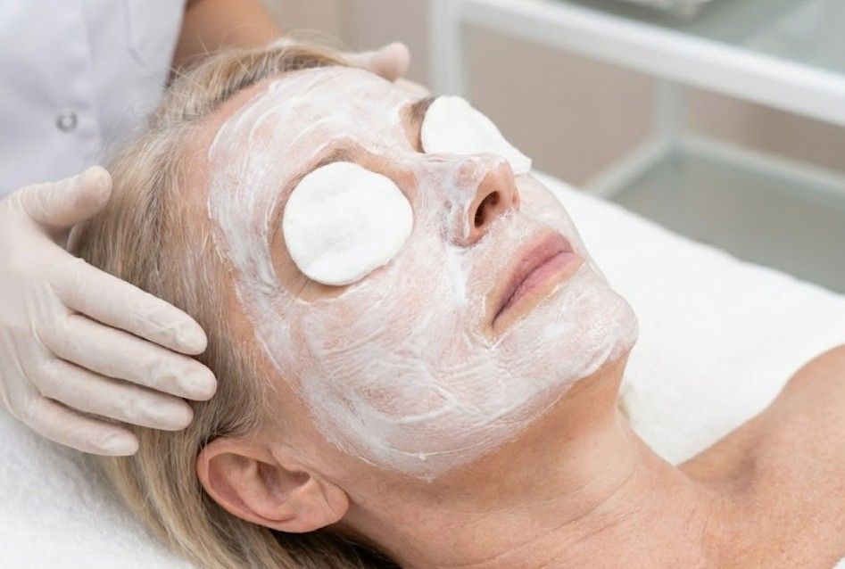 A Skinutrition client after the lactic peel has been on for the appropriate time, having a thick, white neutralizing mask is applied to her face.
