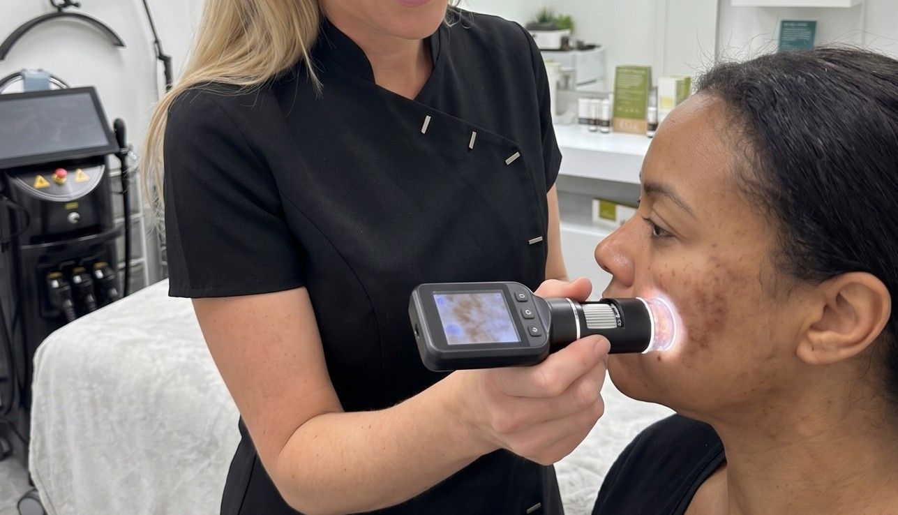 Skinutrition assessing a client's hyperpigmentation levels