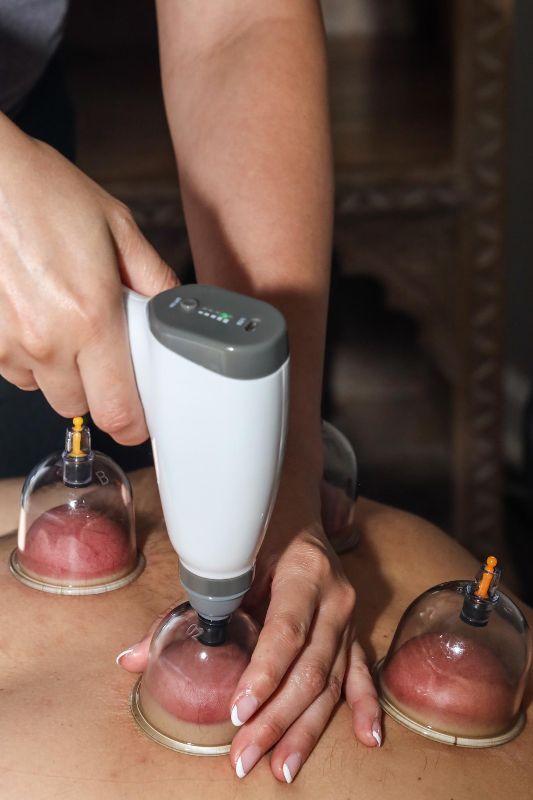 Hands applying cupping therapy to a person's back; suction cups are attached with reddish hues.