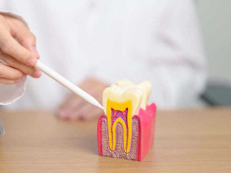 A person is pointing at a model of a tooth with a pen.