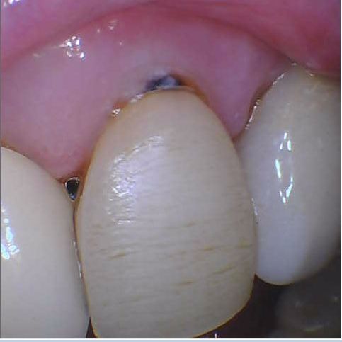 Before and After