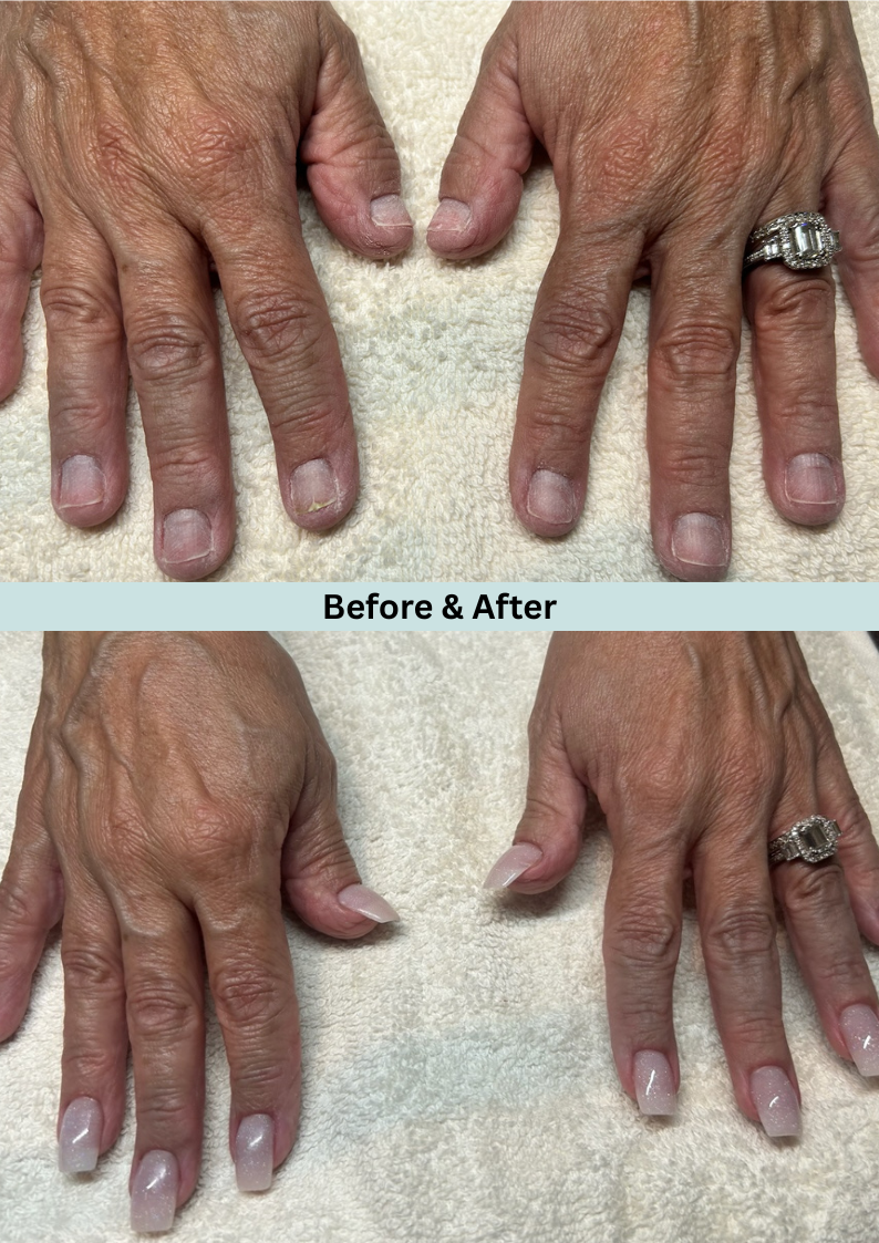 A woman 's hands before and after a manicure and a ring.