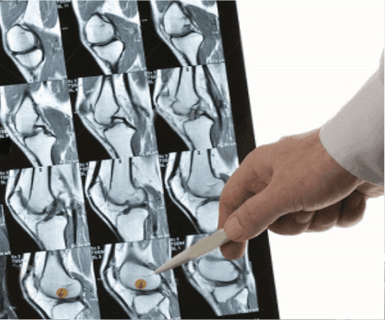 valutazione radiografica