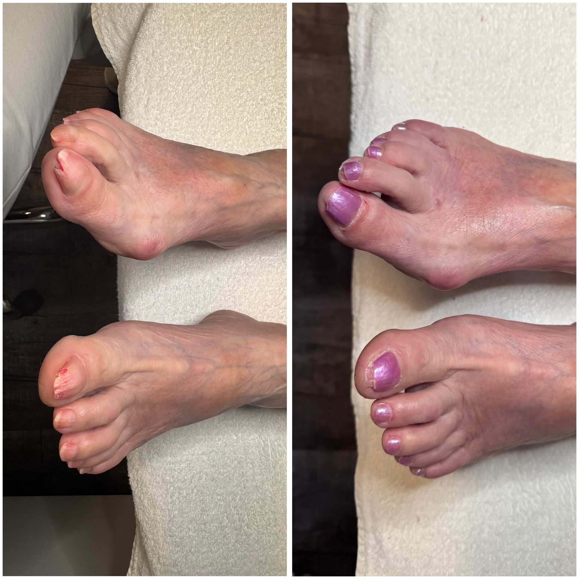 Die Füße einer Frau werden vor und nach einer Maniküre gezeigt.