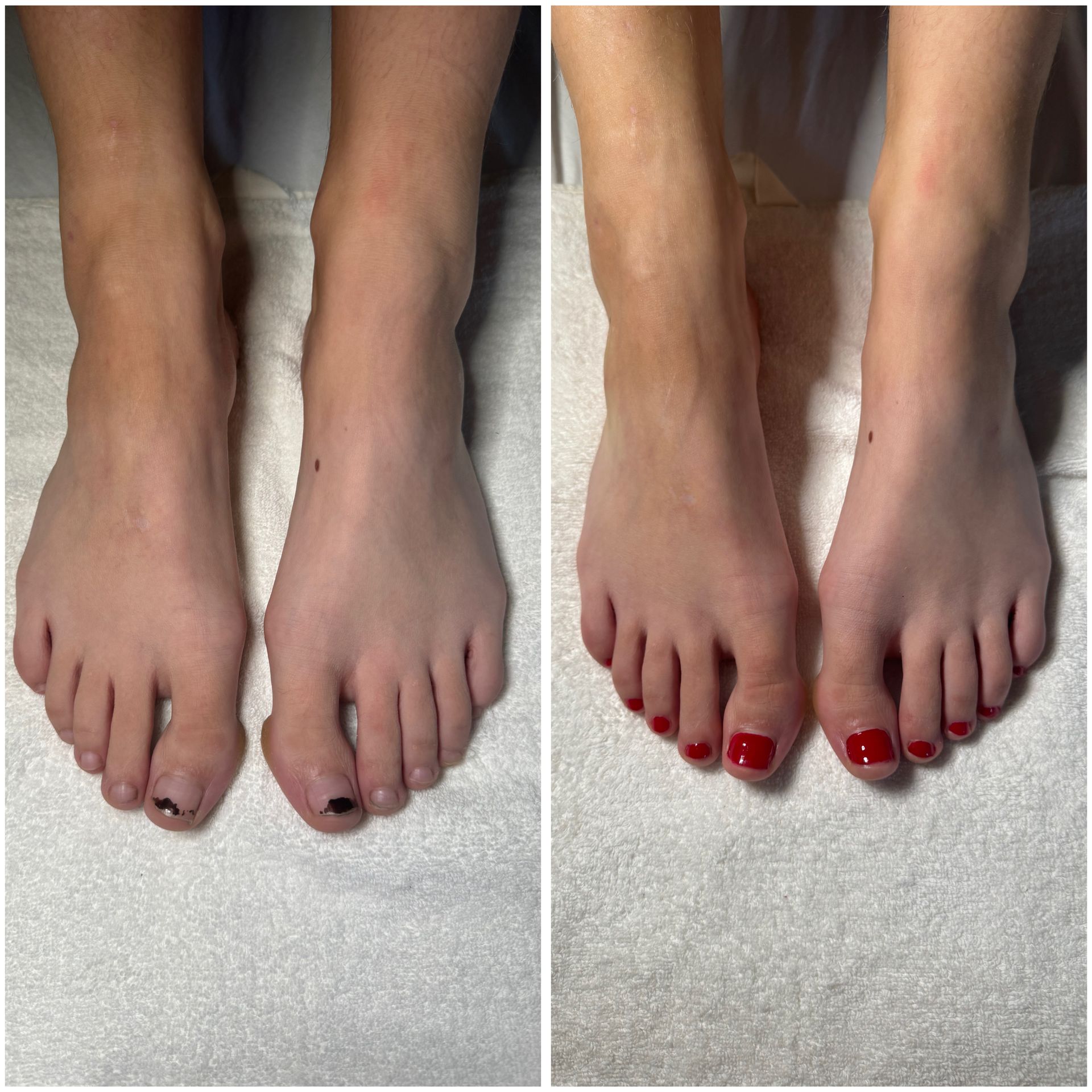 Ein Vorher-Nachher-Foto der Füße einer Frau mit roten Zehennägeln.