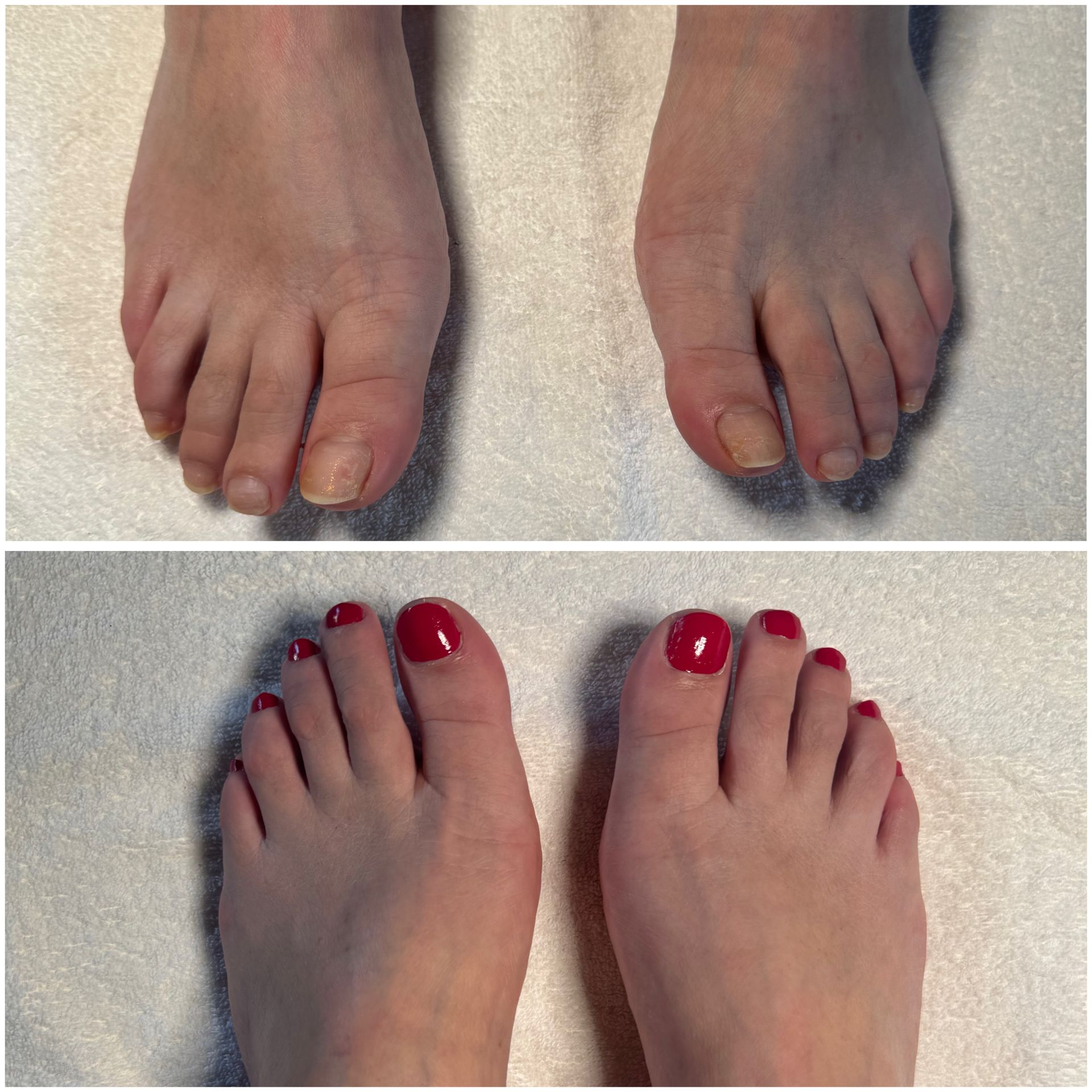 Ein Vorher-Nachher-Foto von Frauenfüßen mit rotem Nagellack