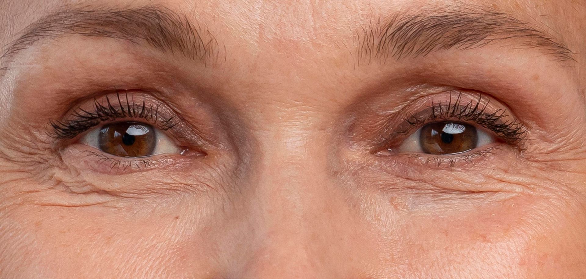 A close up of a woman 's eyes with wrinkles.