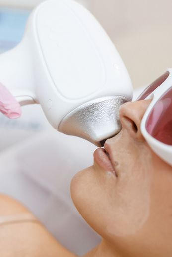 A woman is getting a laser treatment on her face at iinSkin clinic Windsor