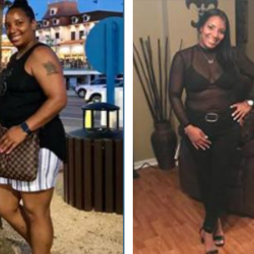 Two pictures of a woman before and after losing weight.
