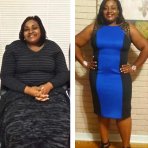 A before and after photo of a woman in a blue and black dress