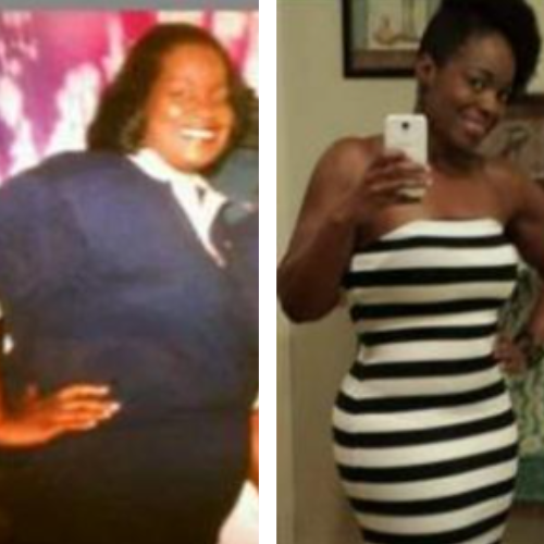A before and after photo of a woman in a striped dress