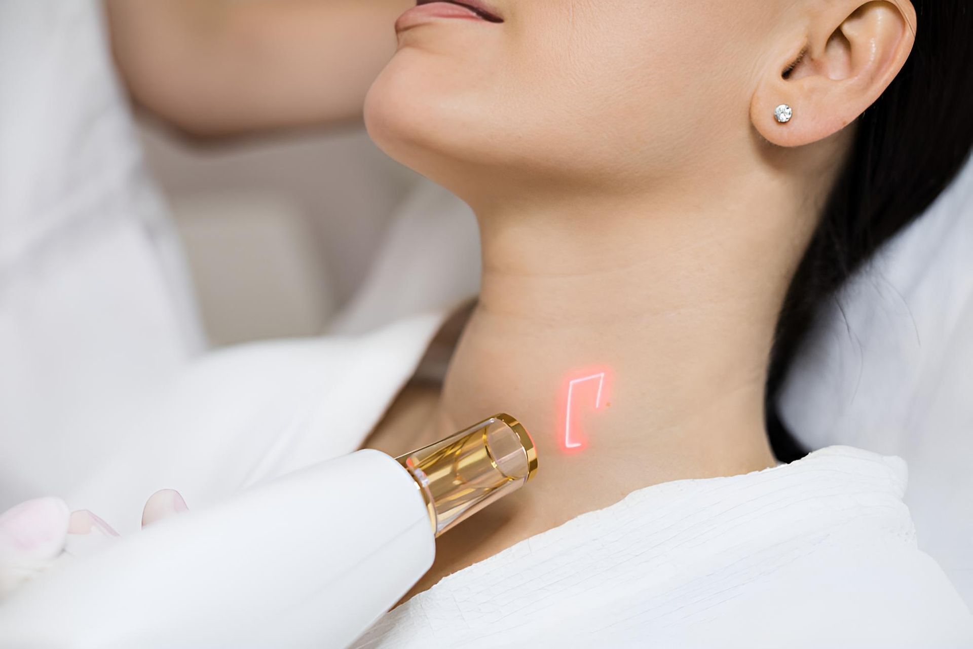 A Woman is Getting a Laser Treatment on Her Neck — Back In Motion Chiropractic & Healthcare In Innisfail, QLD