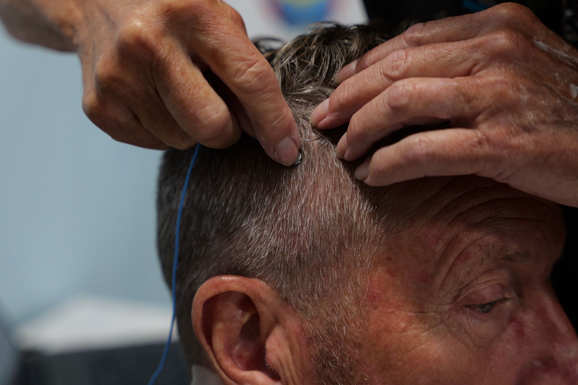 Person receiving head examination with electrodes. Hands are placing wires on the scalp.