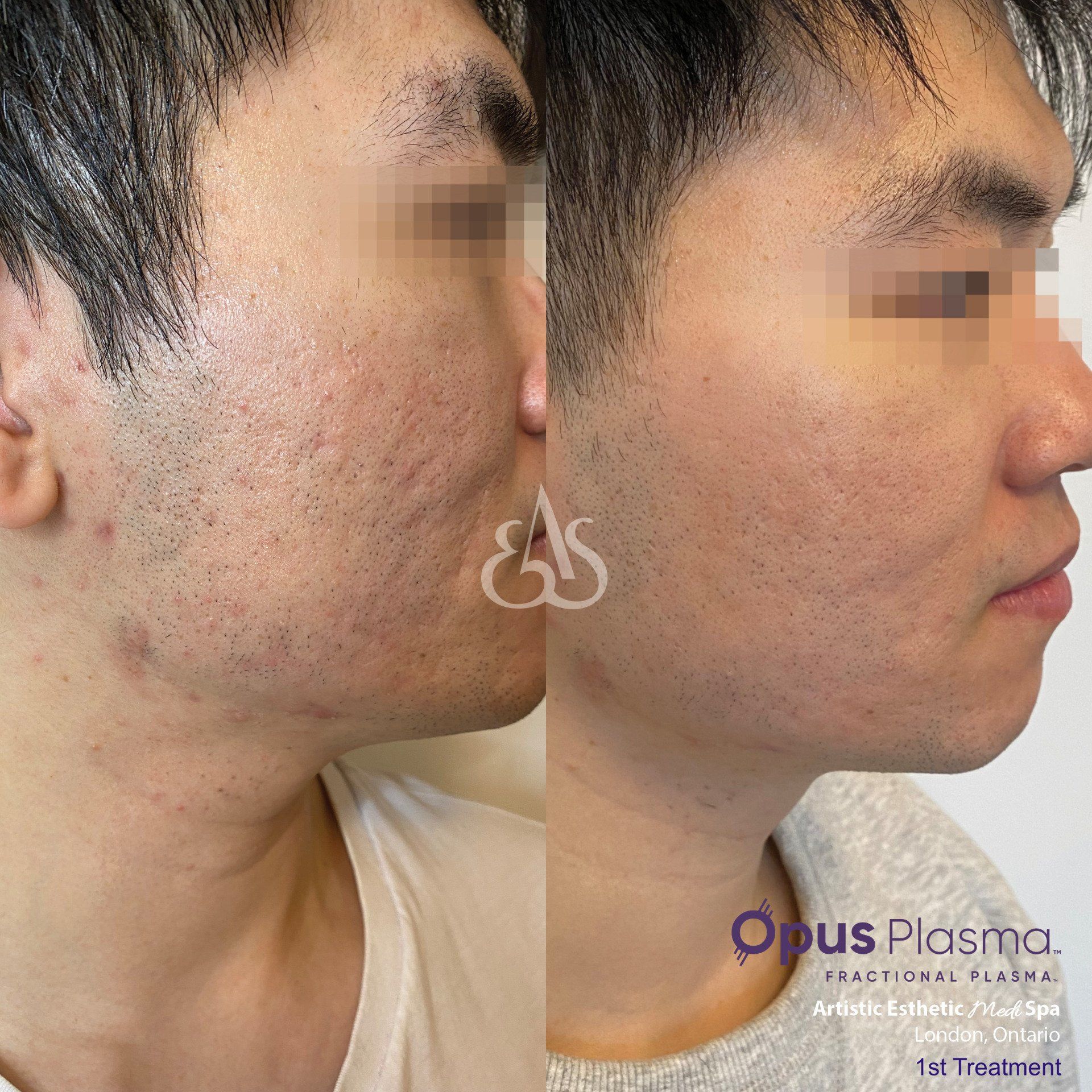 A before and after photo of a man 's face