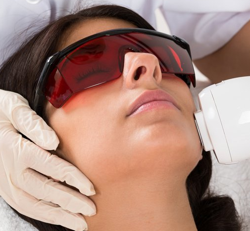 IPL Photo Facial