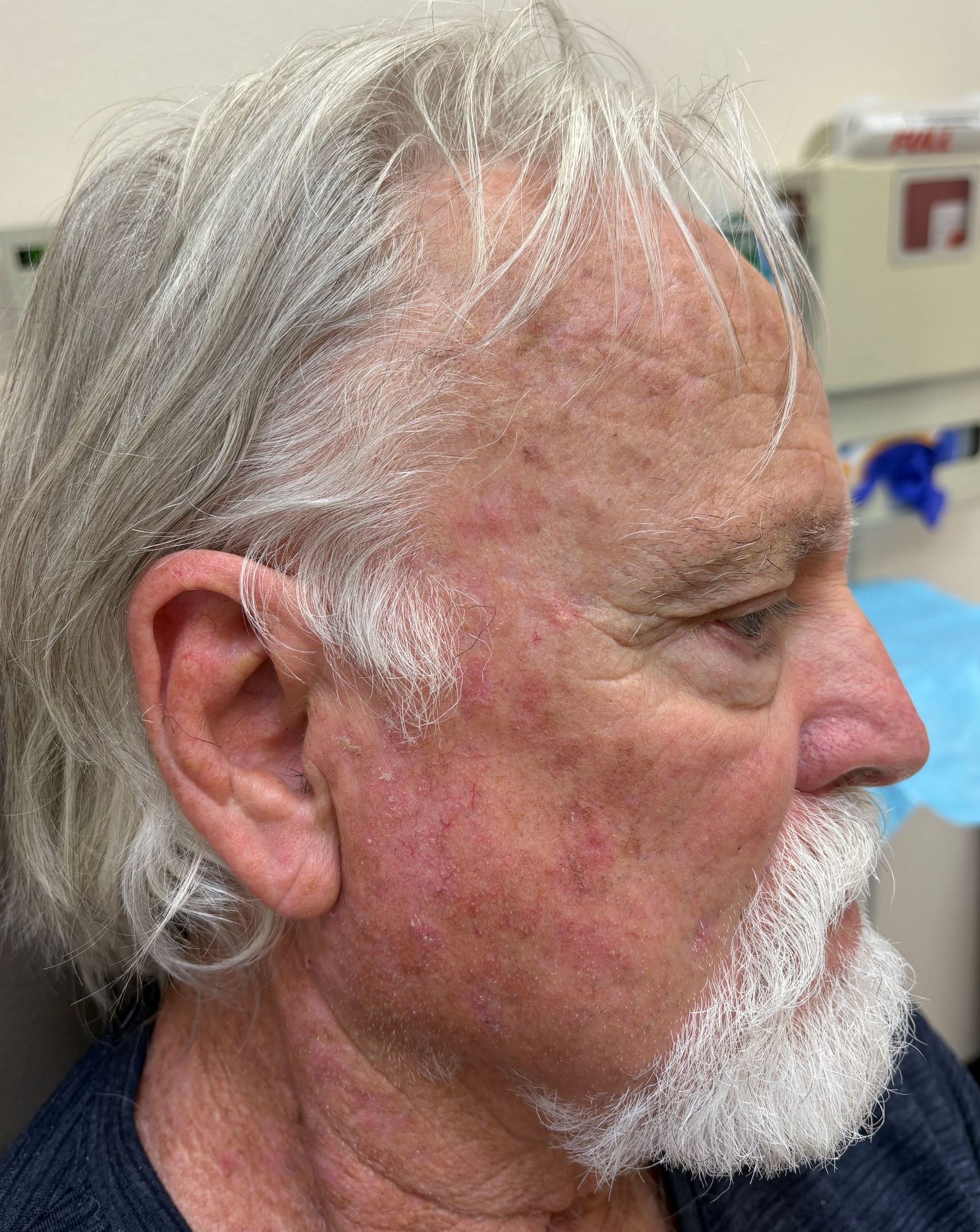 A man with gray hair and a beard is sitting in a chair.