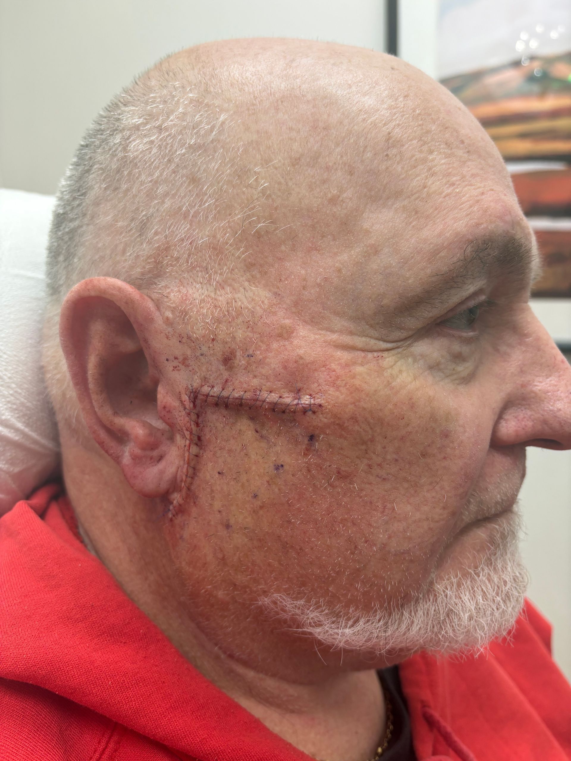 Man with scar on cheek