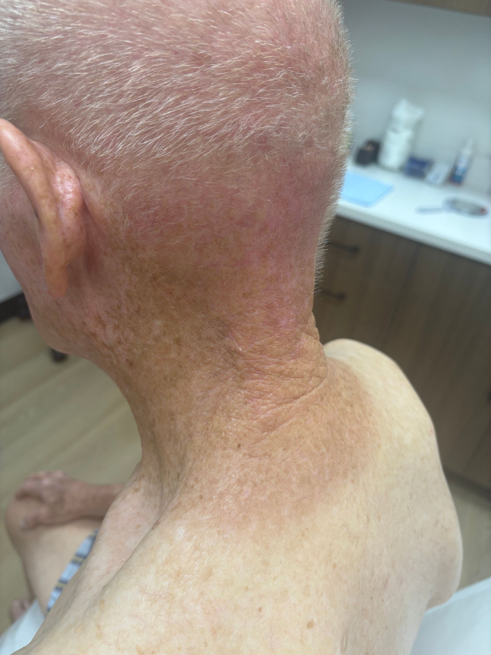 A close up of a man 's neck and head.