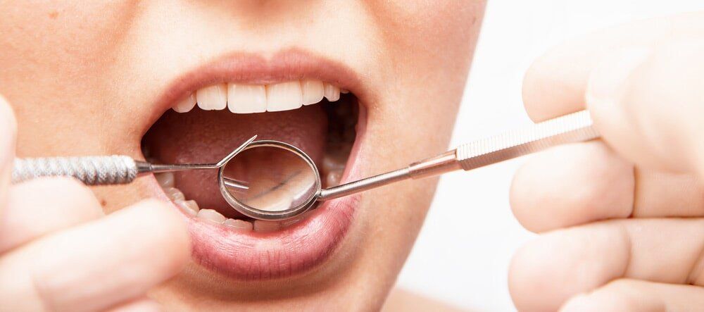 Periodontal Disease — Dental Services in Gympie, QLD